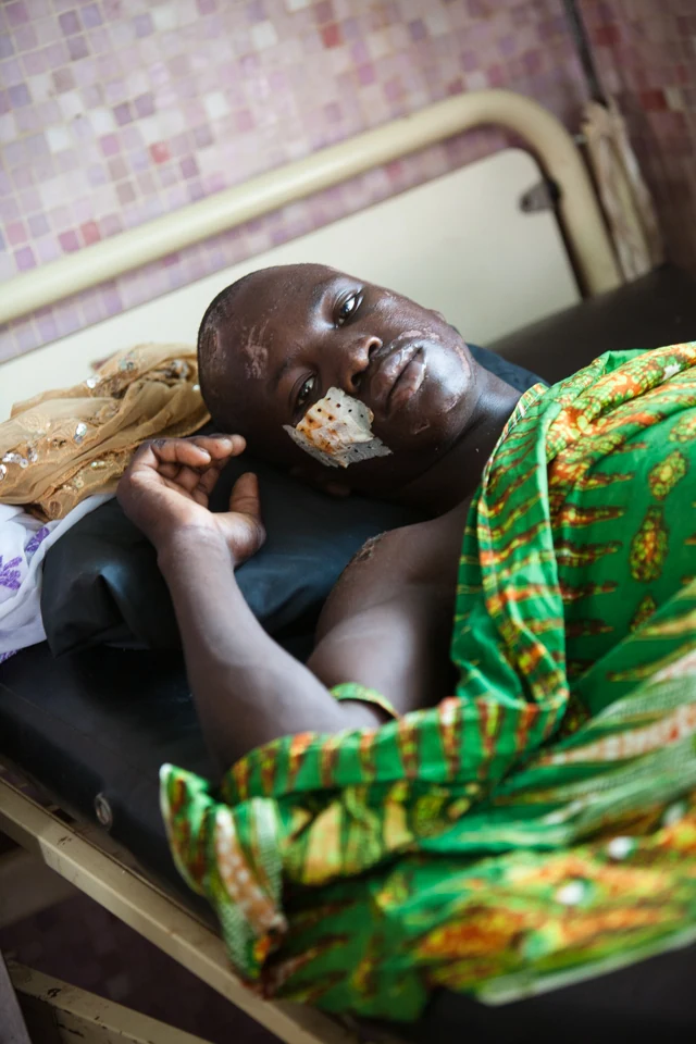A patient waiting for prostate surgery.