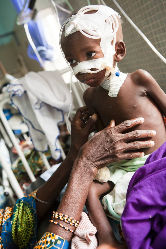 A child receiving care at St-Jean de Dieu Hospital in Benin.
